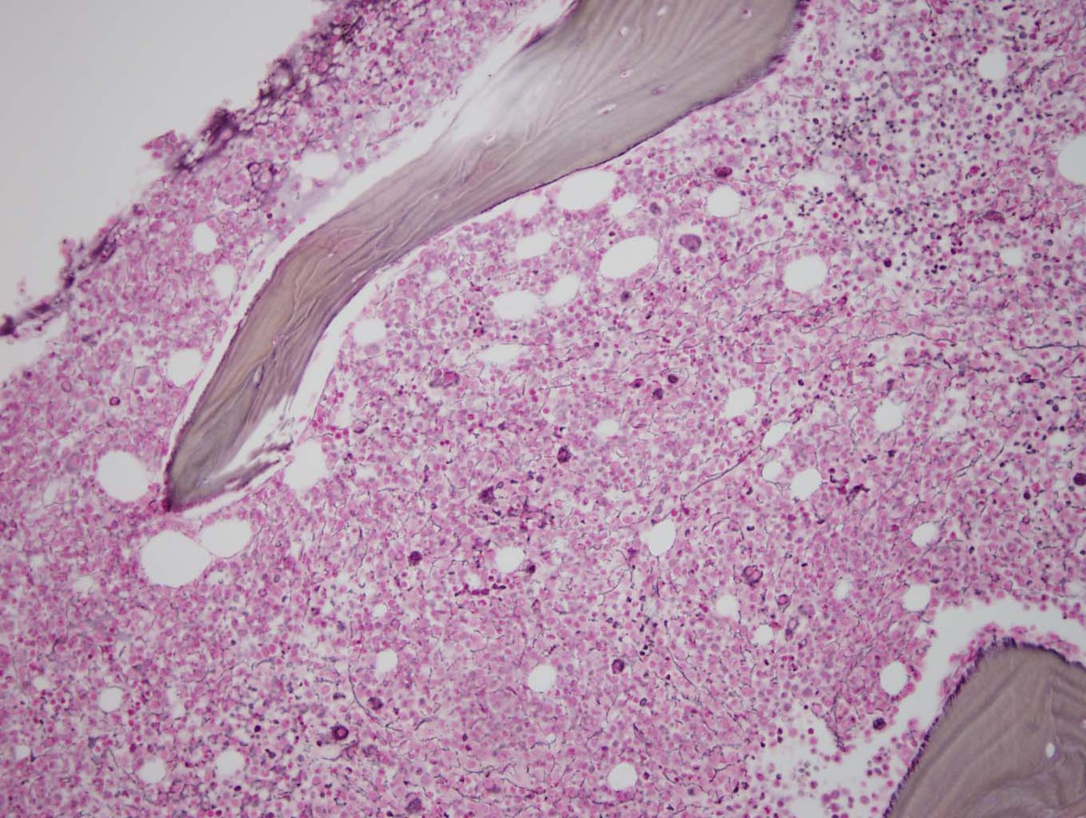 Reticulin stain 
