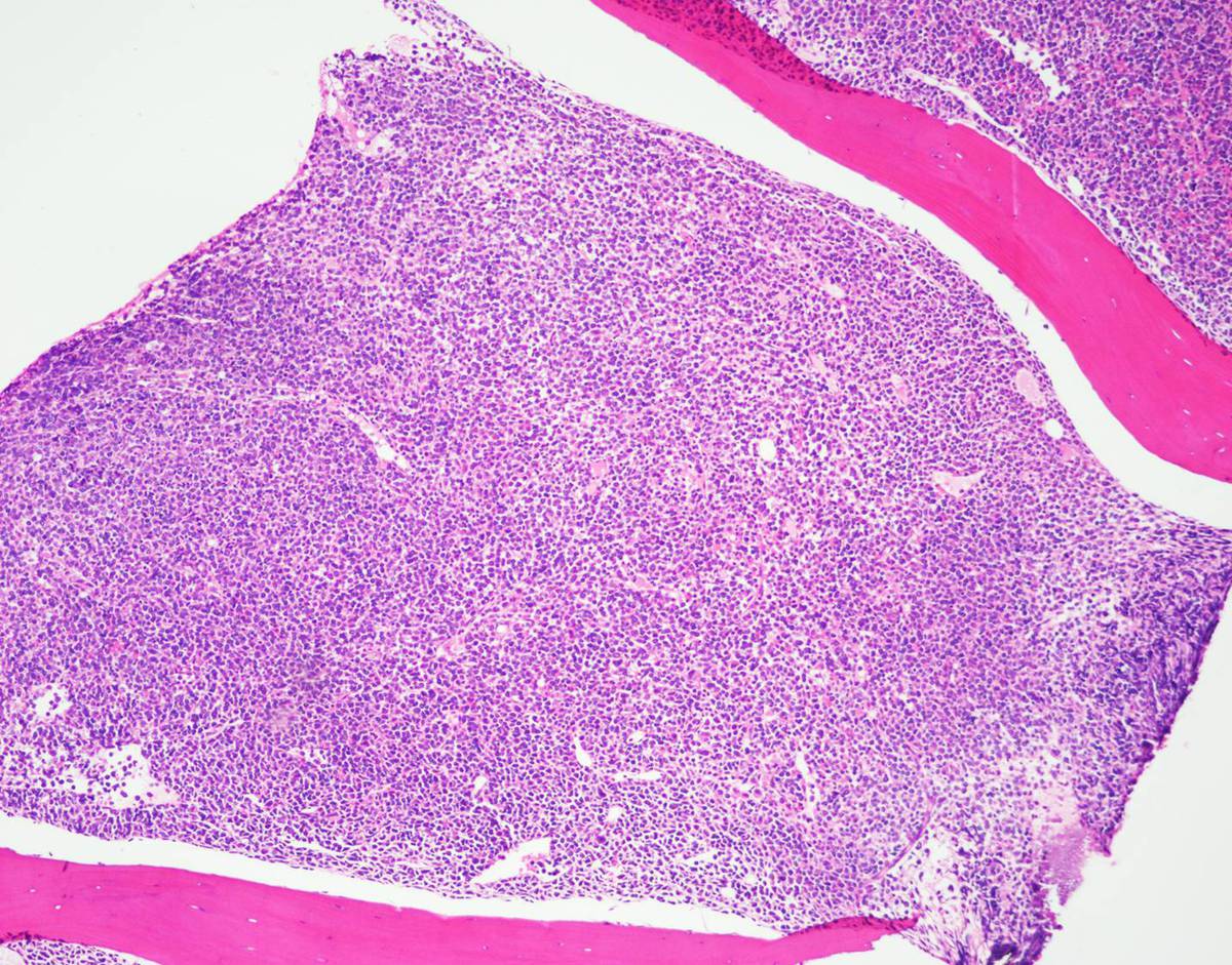 Bone marrow core biopsy, 10X