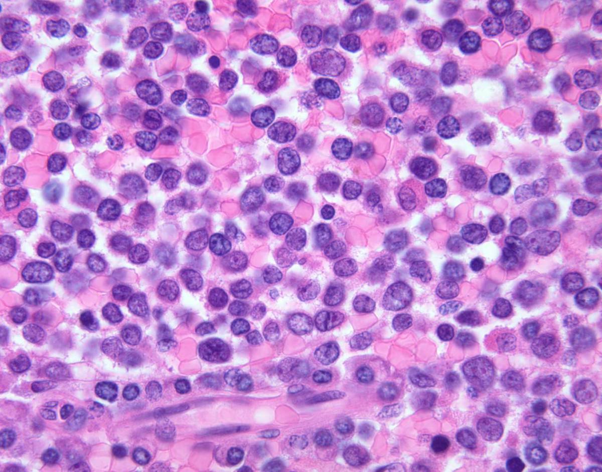Bone marrow core biopsy, 100X