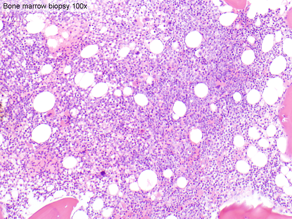 Bone marrow core biopsy (100x)