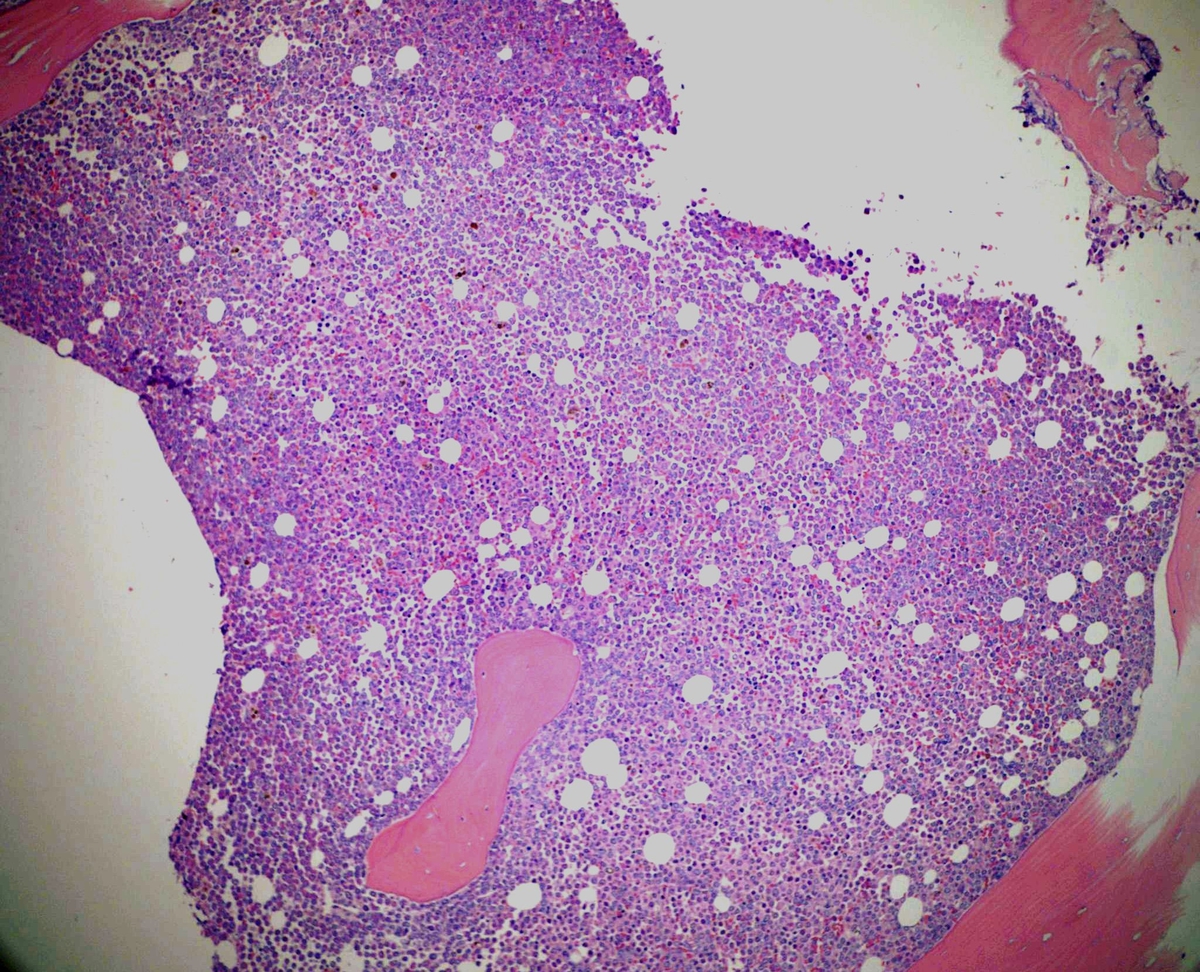 Bone marrow biopsy core at low power