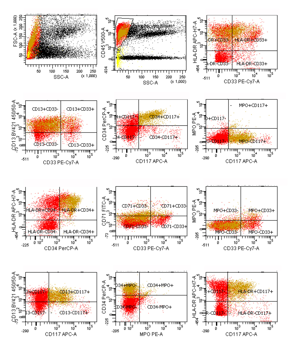 Additional analysis for myeloid and stem cell antigens shows that the CD34+, CD117+ cells (gold) co-express CD13 and HLA-DR.