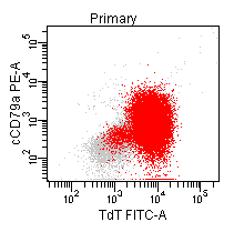Representative histogram of flow cytometry showing blasts with expression of TdT and dim CD79A