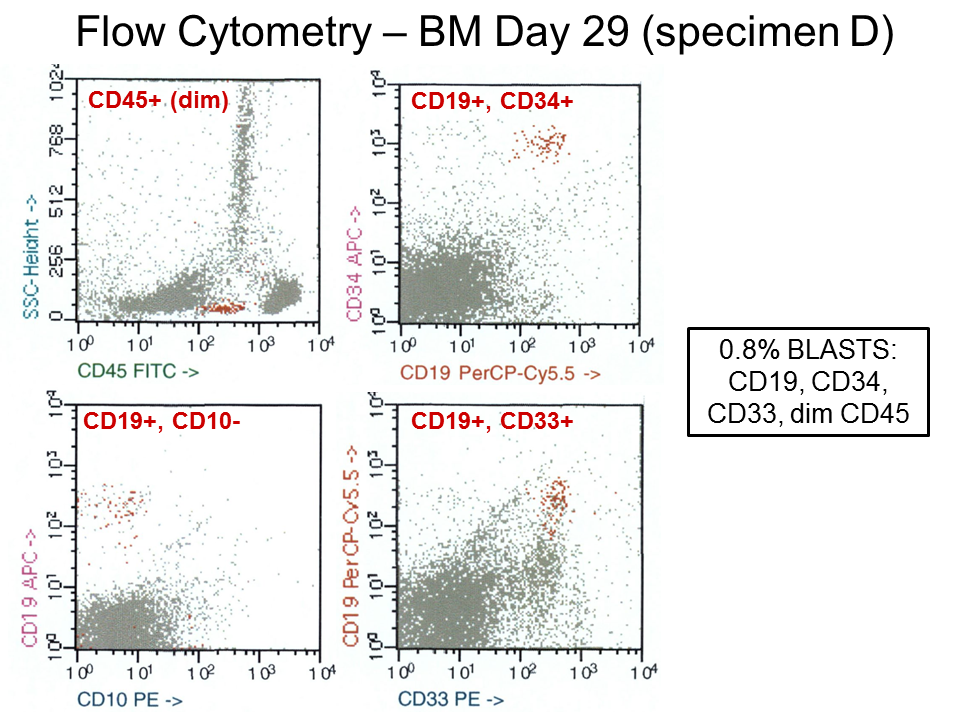 Flow cytometry of bone marrow, day 29 (D) of induction therapy