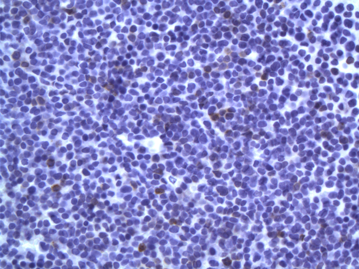 CD79a Lab2