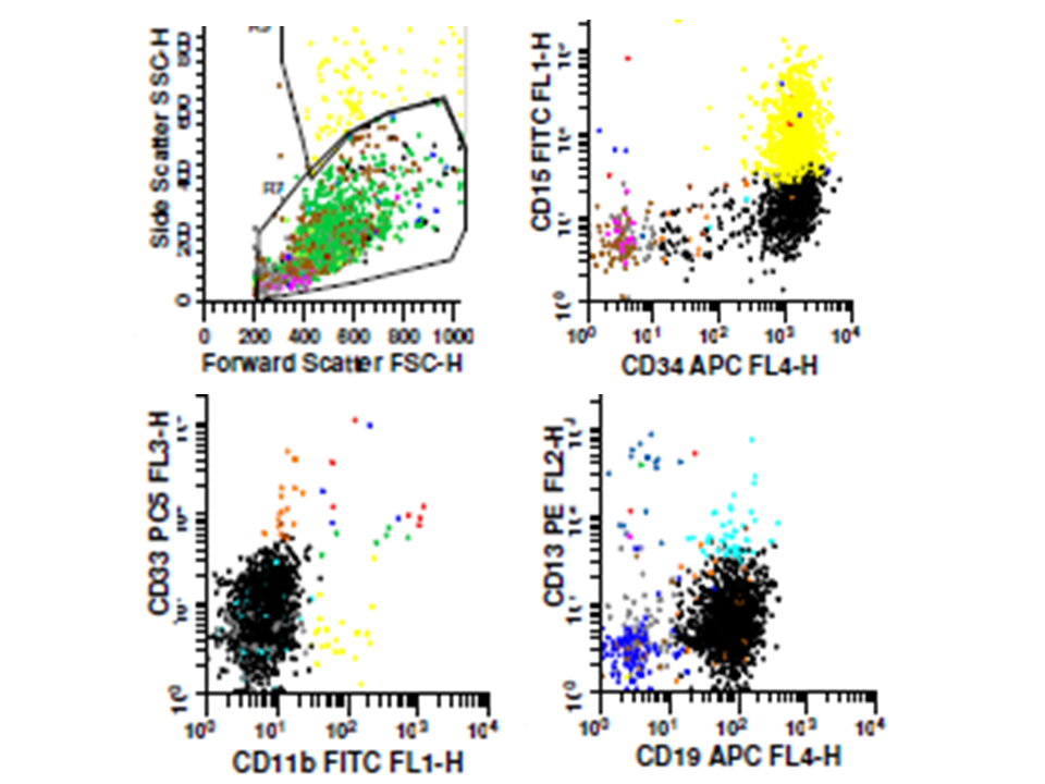 Flow cytometry marrow aspirate in Lab2
