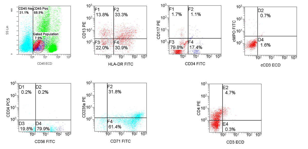Flow cytometric analysis: gating on dim CD45 vs low side scatter population and CD45 negative population