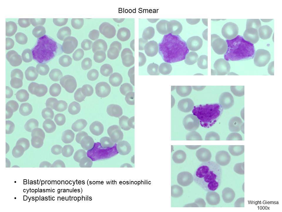 Fig 1. Blood