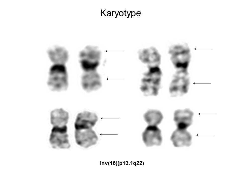 Fig. 4 Karyotype Selection