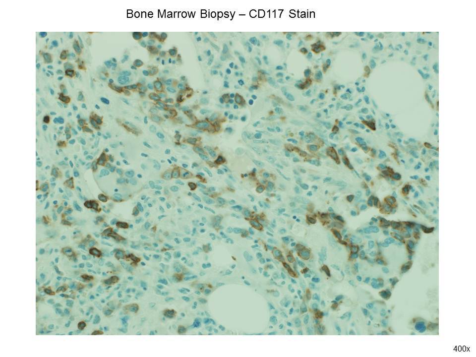 Fig. 9 CD117 Stain