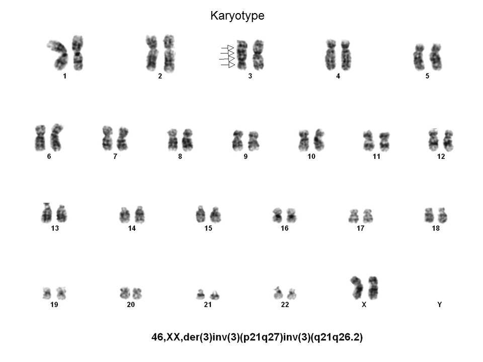 Fig. 10 Karyotype