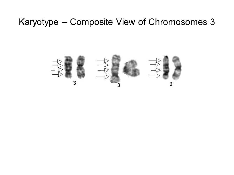 Fig. 11 Composite View of Chromosomes 3