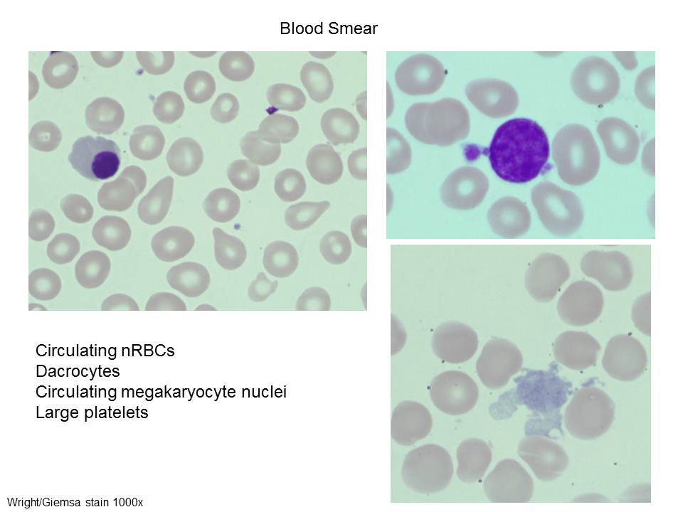 Fig. 1 Blood
