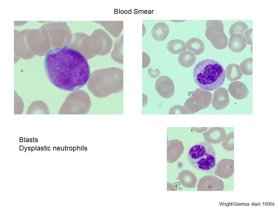 Fig. 2 Blood