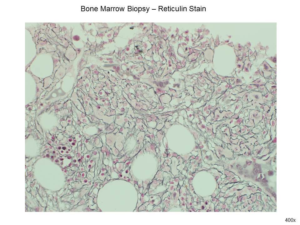 Fig. 6 Reticulin Stain