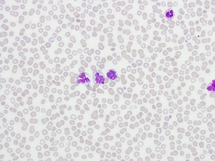 Peripheral Blood