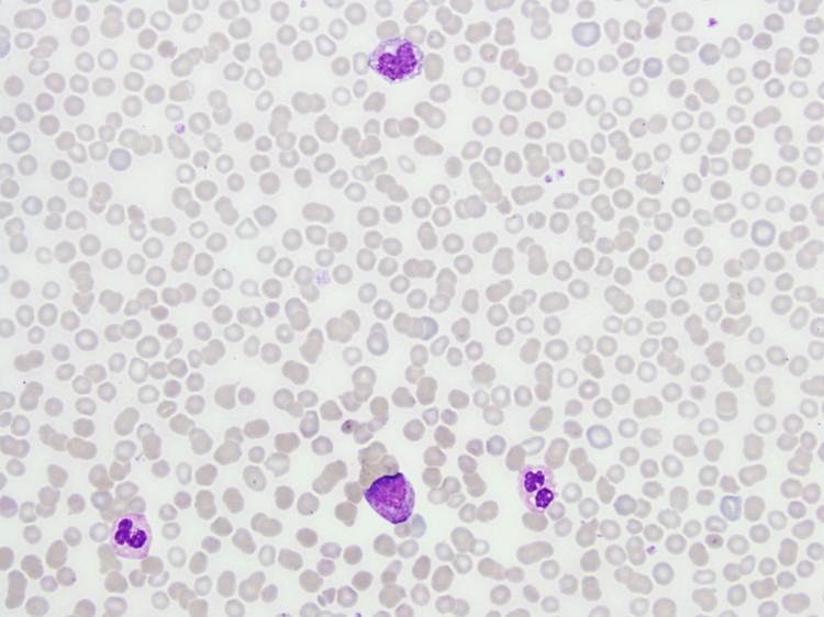 Peripheral Blood