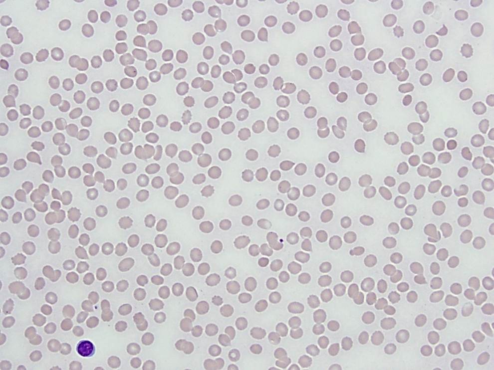 Peripheral Blood