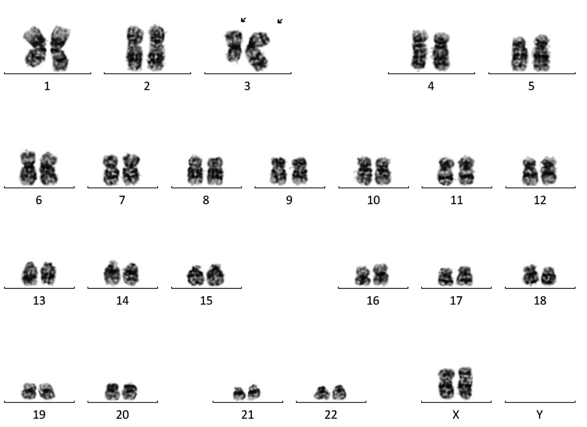 Karyotype