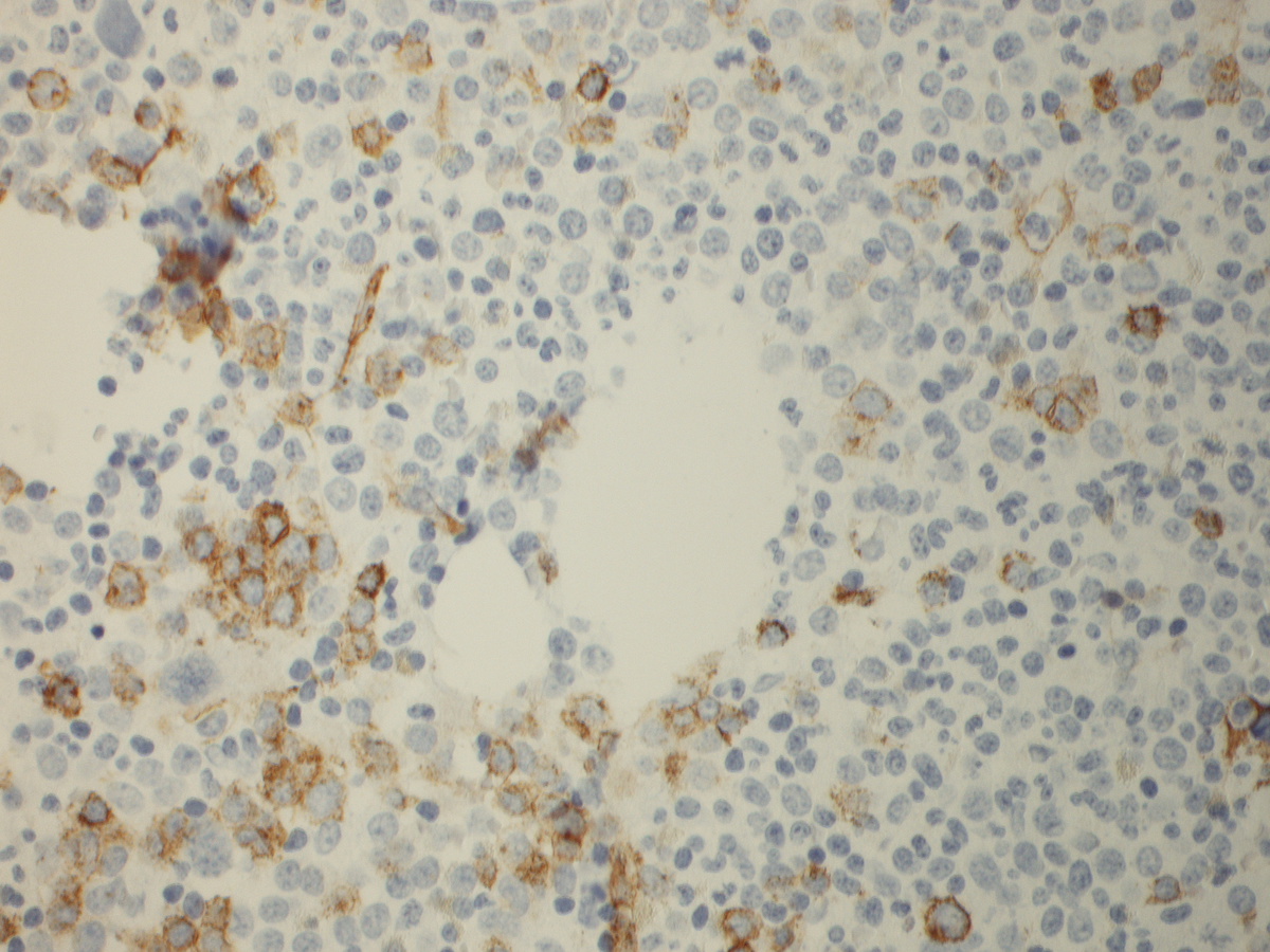 CD34
