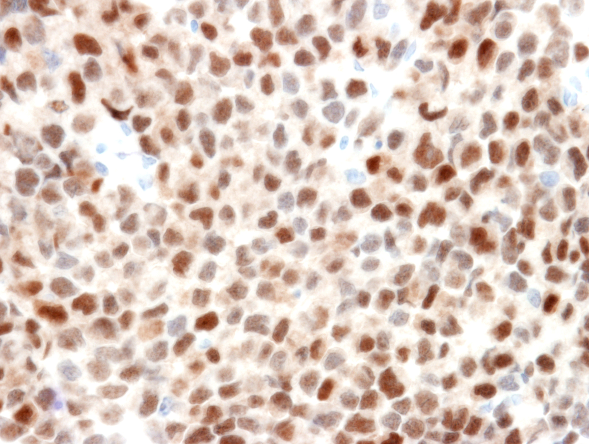 Specimen 4, TdT x 400
