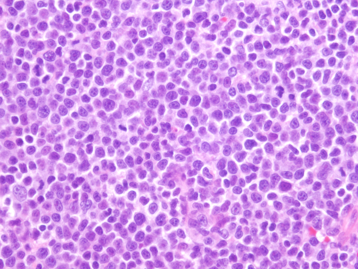 Specimen 2, H&E x 400