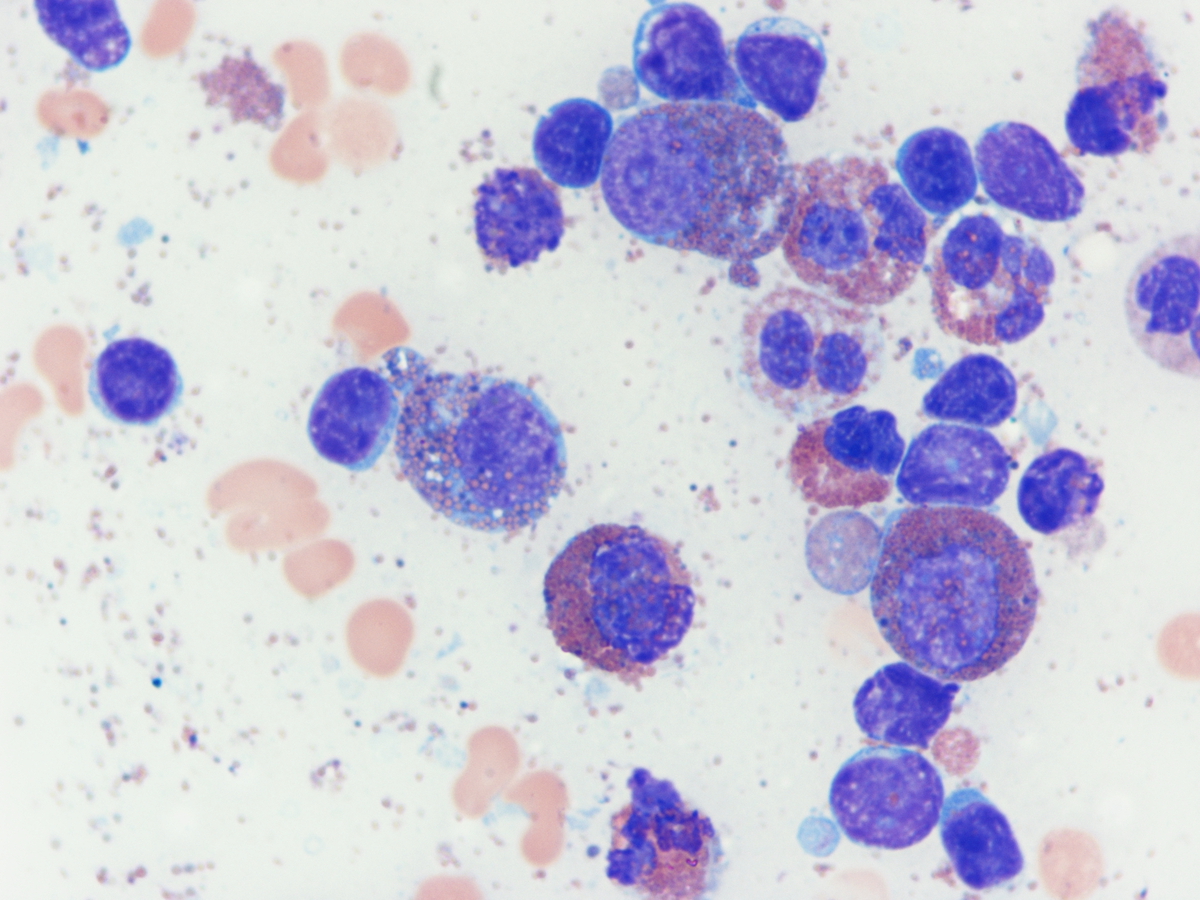 Figure 2. Bone marrow aspirate field, 1000X