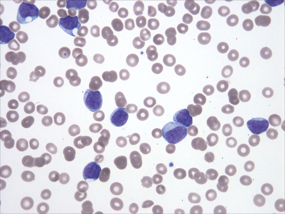 Peripheral blood