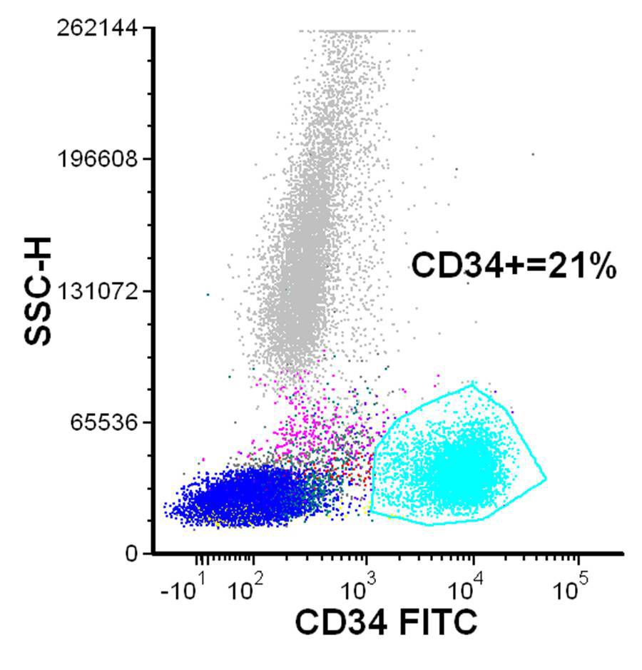 Flow Cytometry plot highlighting increased CD34+ myeloblasts