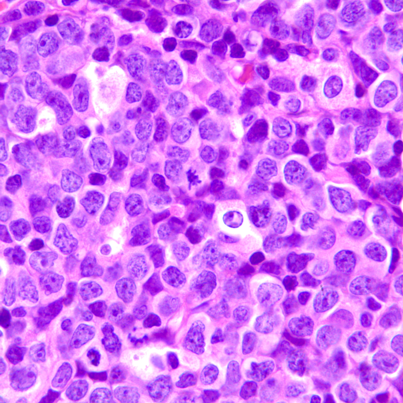 lymph node H&E section