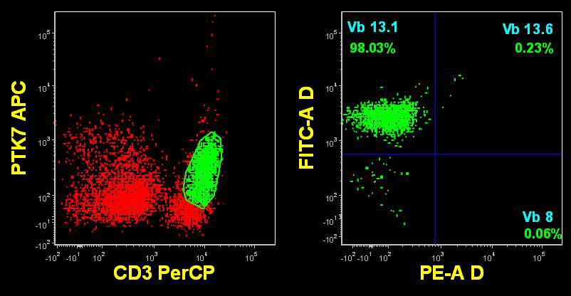 TCR Vbeta analysis performed on relapse BM sample (2/2012). The PTK7+ T cells (green) are large and show restriction of the VB13.1 subfamily