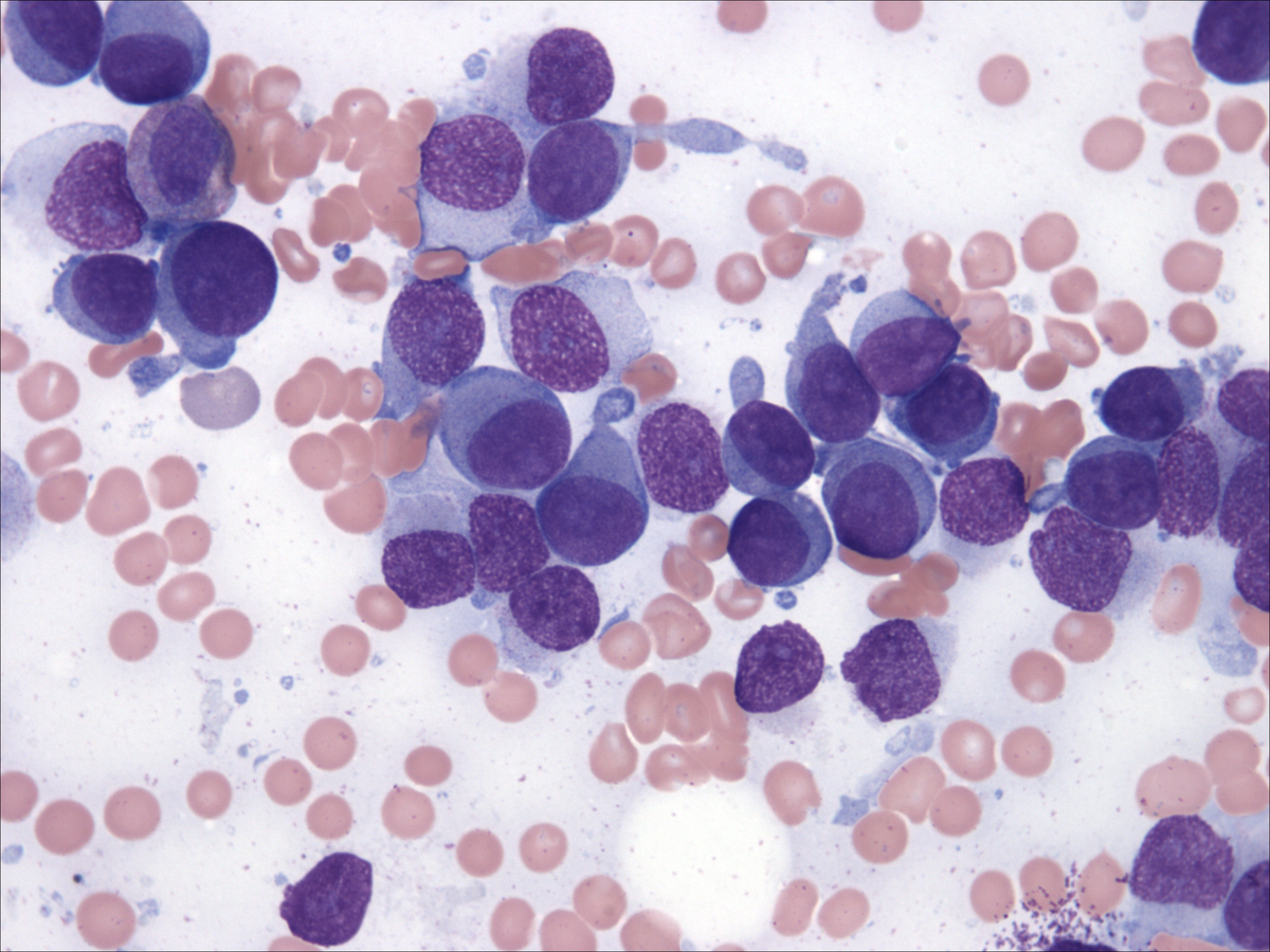 Bone marrow aspirate