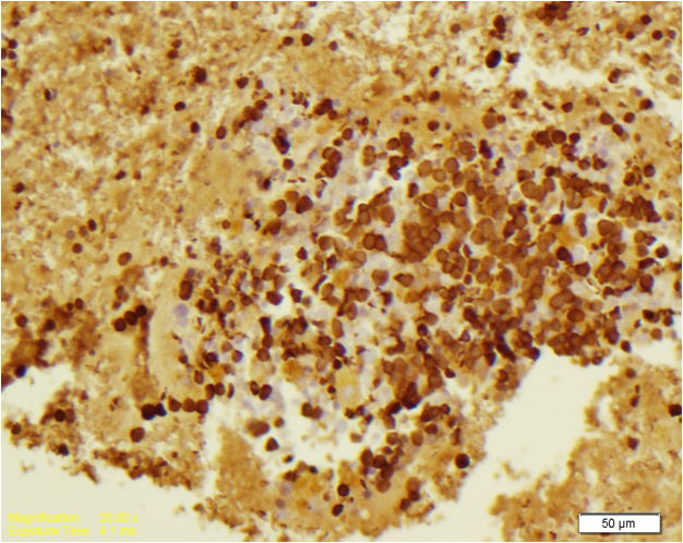 Hemoglobin A