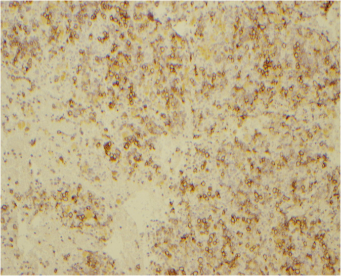 E-cadherin