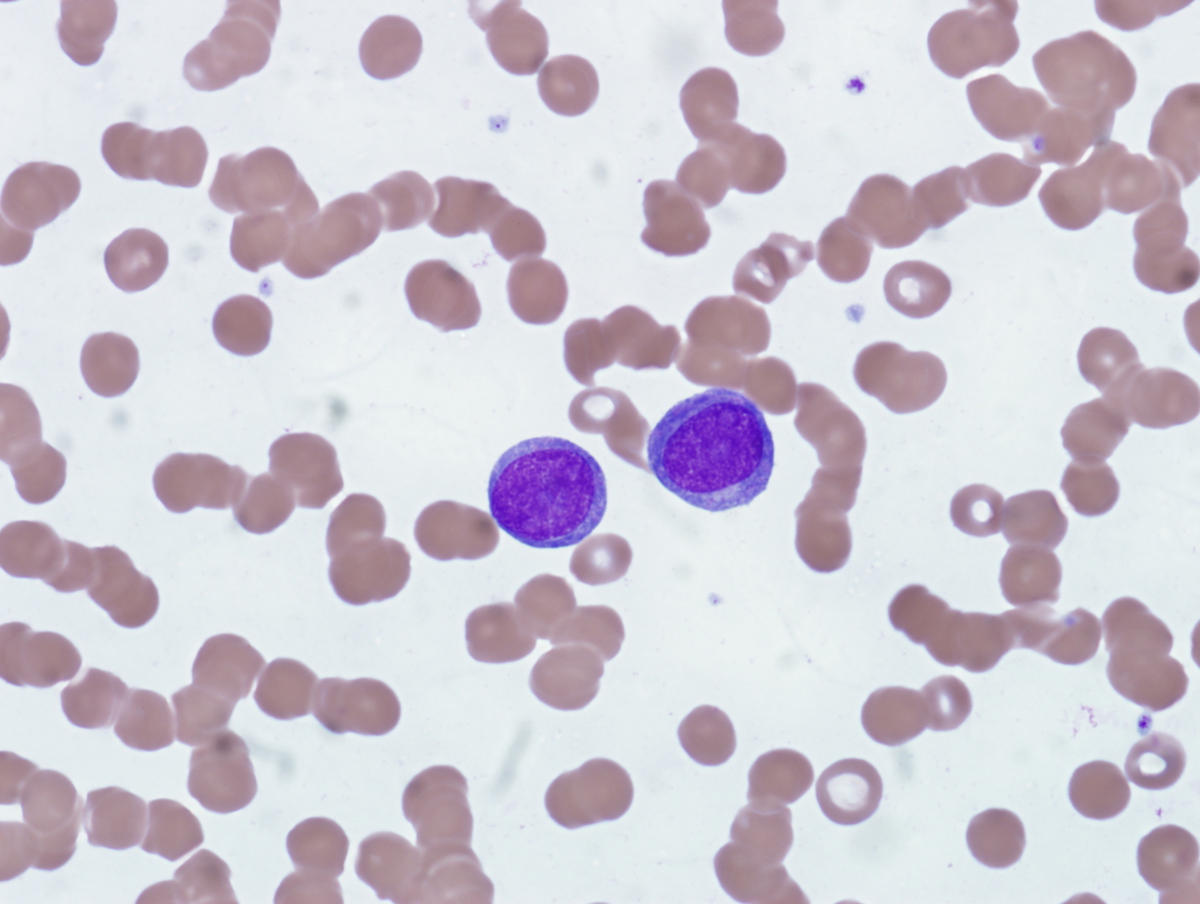 Peripheral blood