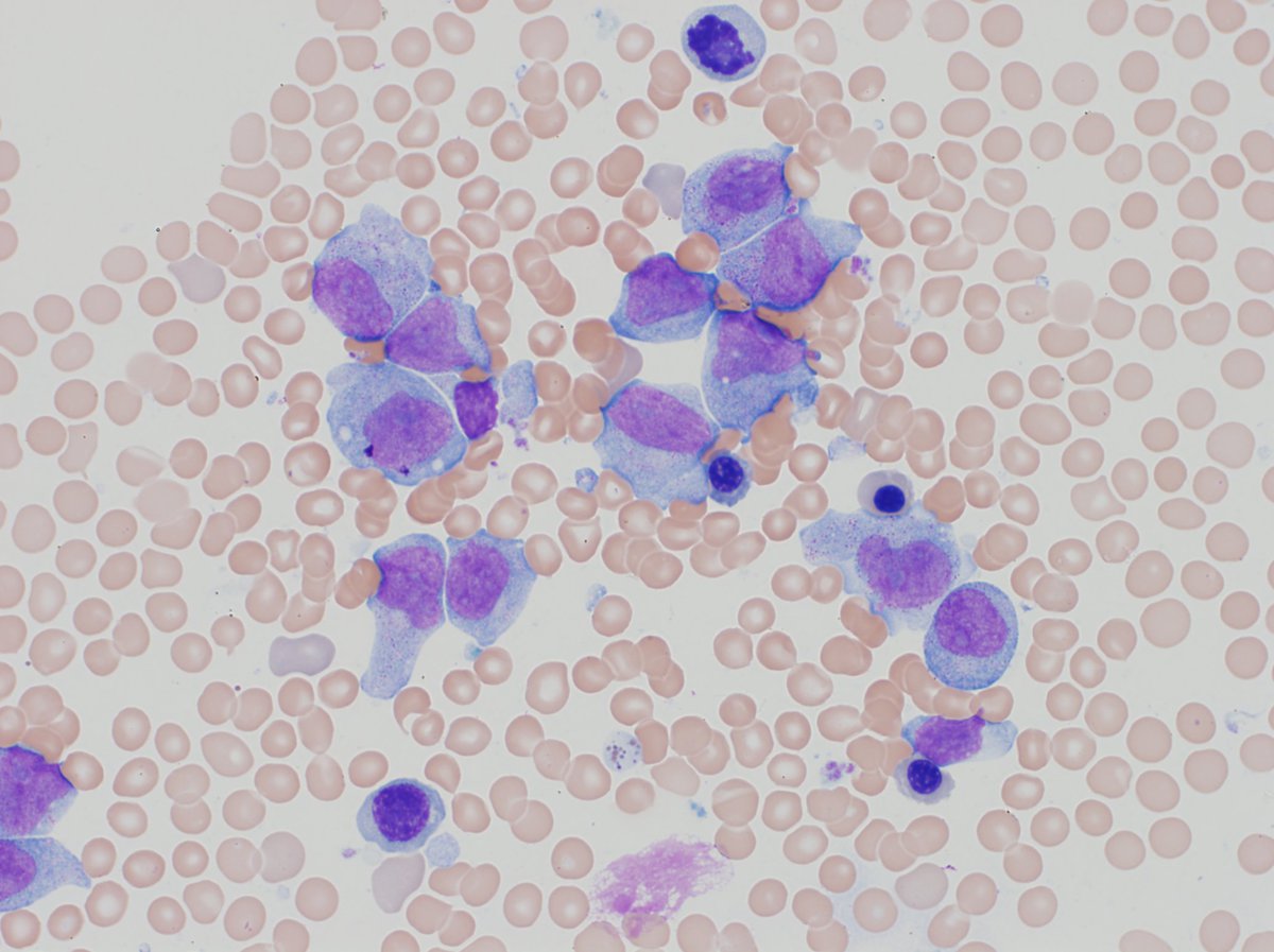BM1