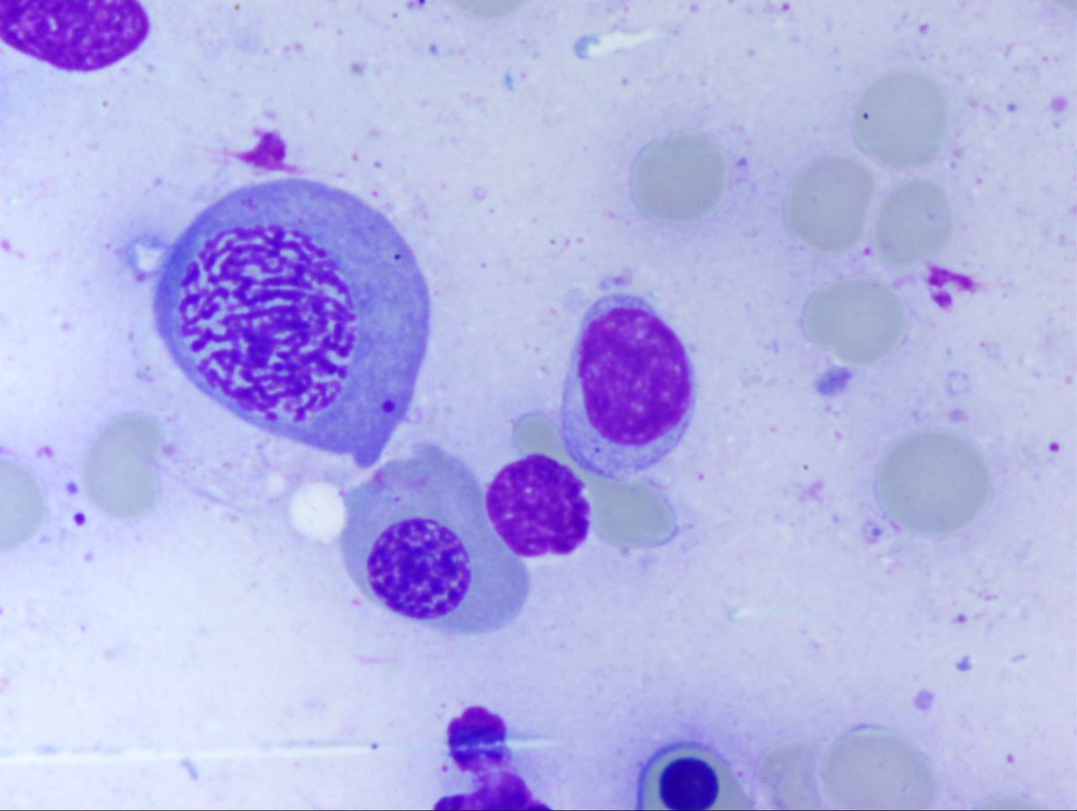 Aspirate 1