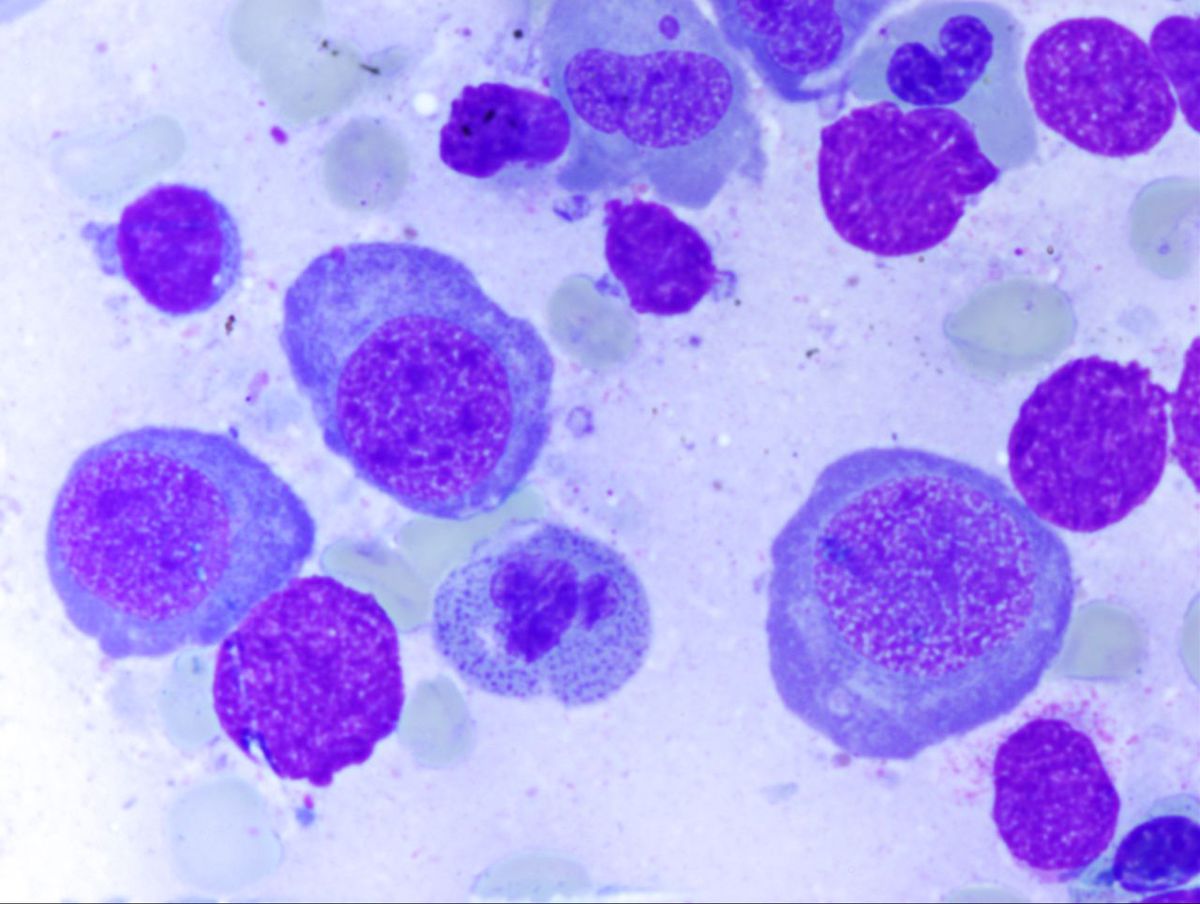 Aspirate 2