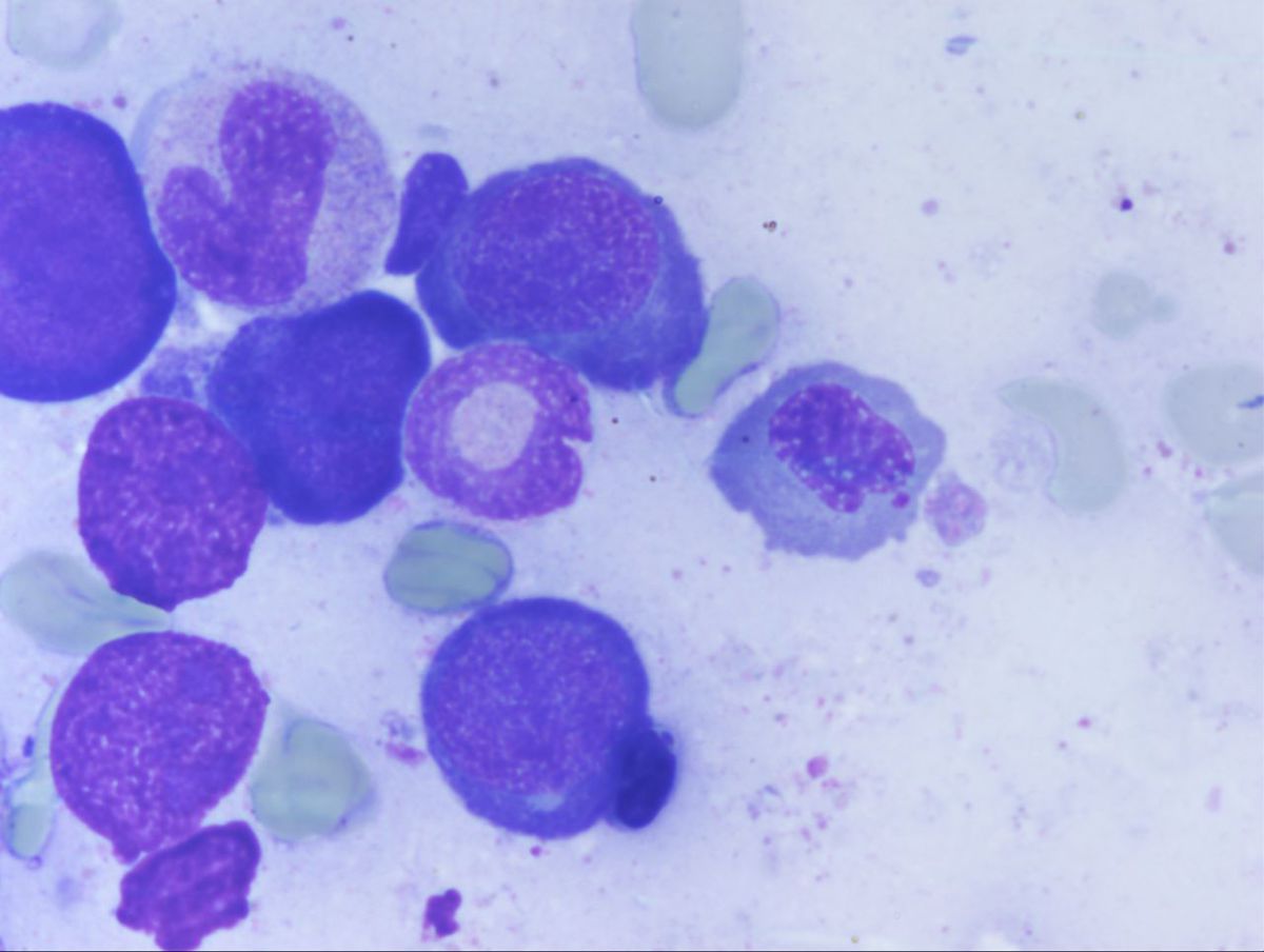 Aspirate 3