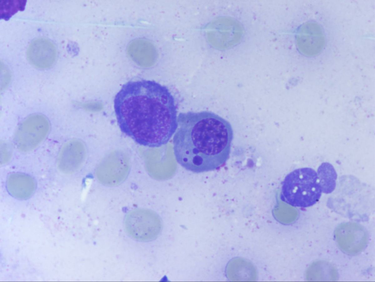 Aspirate 4