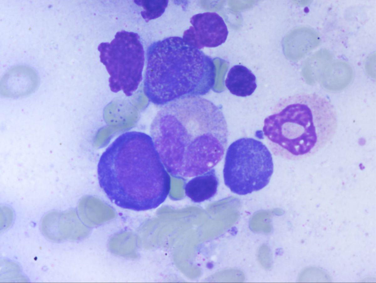 Aspirate 5