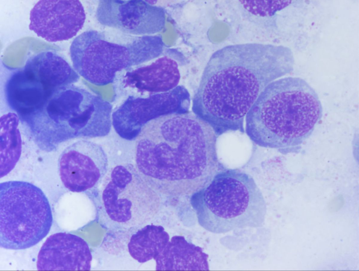 Aspirate 6