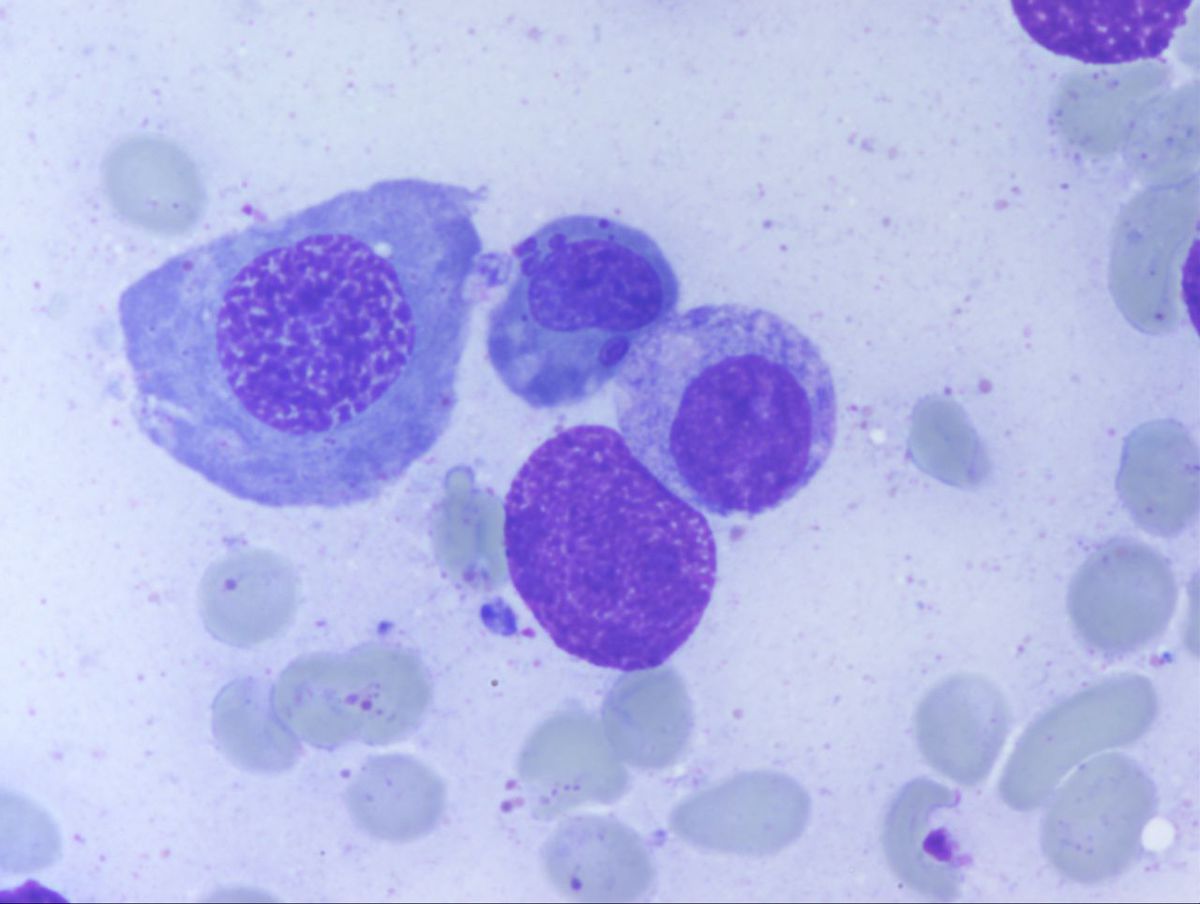 Aspirate 7