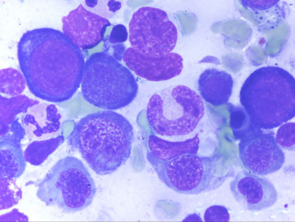 Aspirate 8