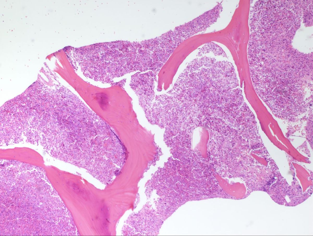 Bone Marrow Core 1
