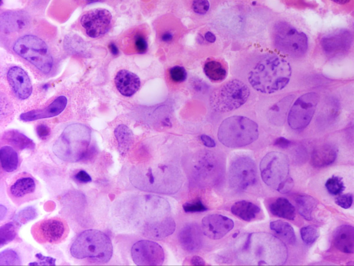 Bone Marrow Core 2
