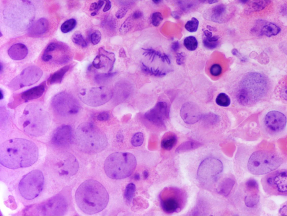 Bone Marrow Core 3