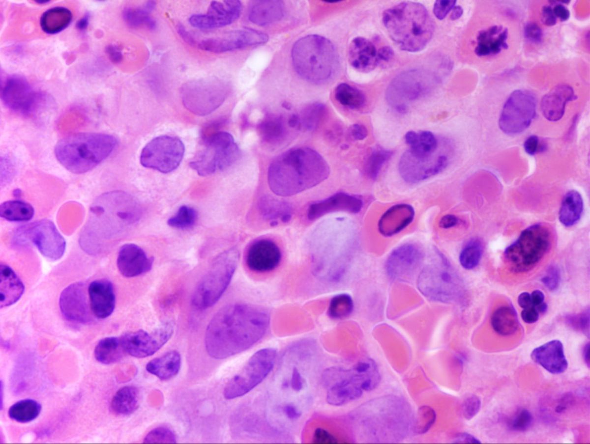 Bone Marrow Core 4