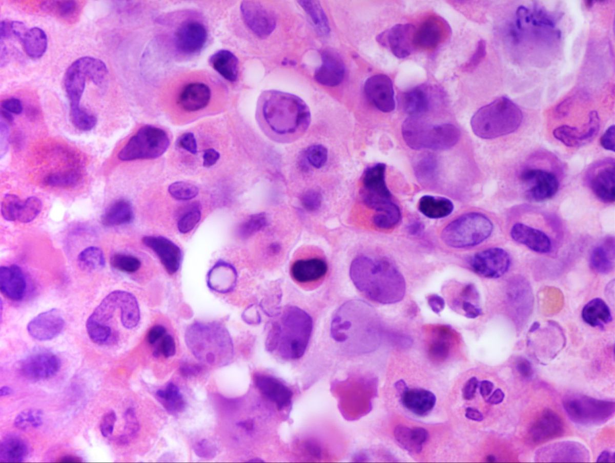 Bone Marrow 5