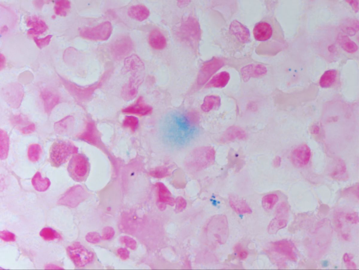 Iron Stain